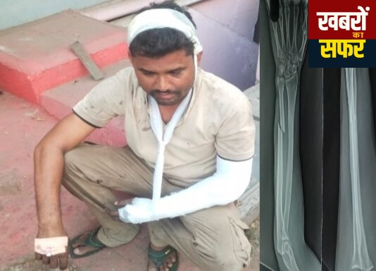 सिर पर लाठी से गैगवार 8 टांके और हाथ की हड्डी टूटी